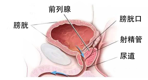 普樂安片治療前列腺炎的療程與效果，深度解析，普樂安片治療前列腺炎療程與效果深度解析，療程長短與治療效果一覽無余。